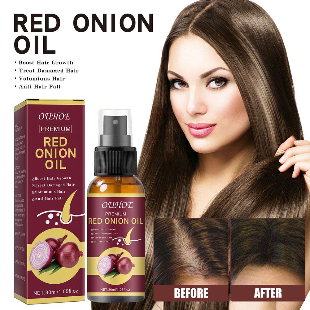 Onion Hair Growth Oil Spray Strengthens Hydrates Hair Promotes Dense Thick Treatment 1/2PCS