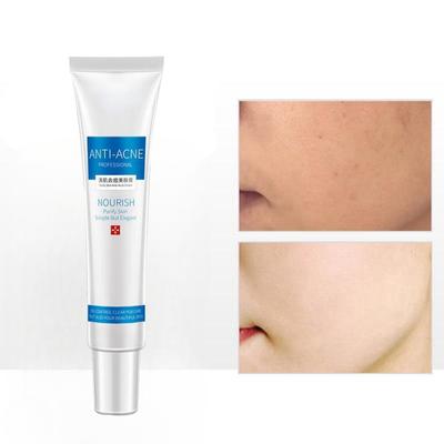 Крем для лечения прыщей, увлажняющее масло для контроля, сужение пор, удаление следов, средство для удаления прыщей