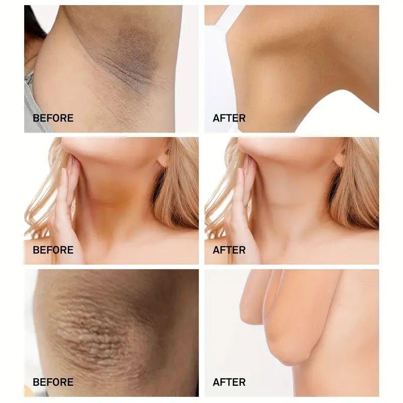 Крем для кожи увлажняет, питает и осветляет кожу.. Лосьоны для тела и осветляющие кремы для уменьшения тусклости кожи