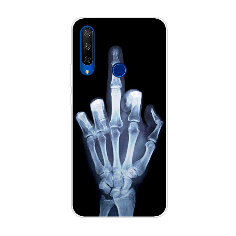 Для ALCATEL 1S 2020 Чехол Защитная Крышка Телефона Мягкий Силиконовый Задний Чехол для Alcatel 1S 1SE Coque Alcatel 1V 3L 2020 Чехлы Ударопрочная Крышка