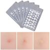 72 шт., лечебные пластыри от прыщей и прыщей, невидимые наклейки для ухода за пятнами на лице