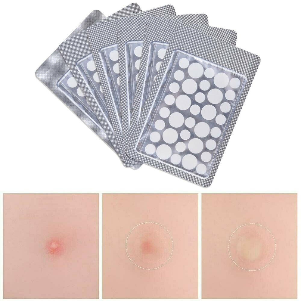 72 шт., лечебные пластыри от прыщей и прыщей, невидимые наклейки для ухода за пятнами на лице