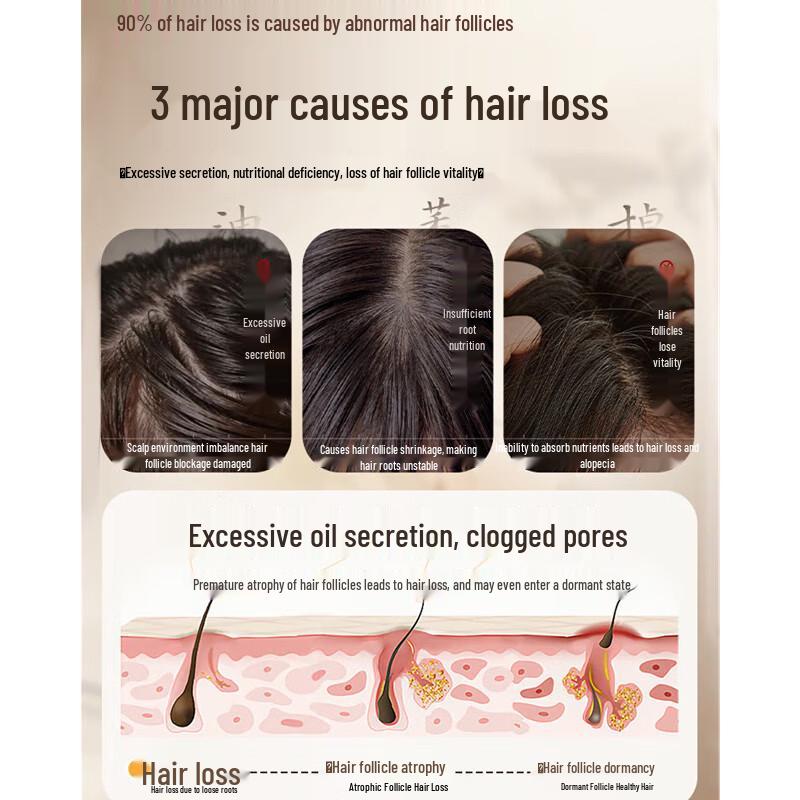 Vitess Ginger Anti-Hair Loss Strengthening Shampoo