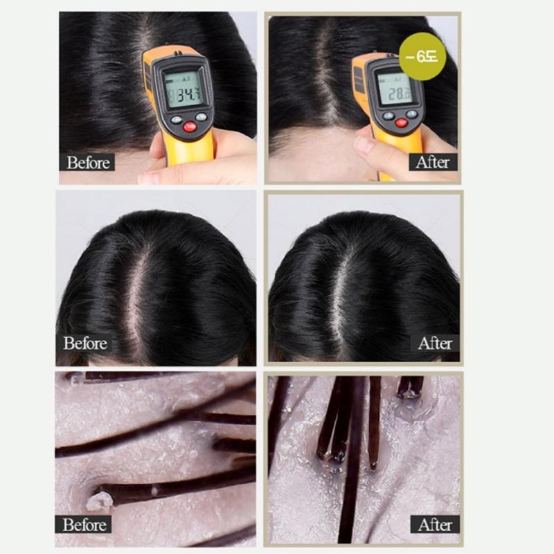 Daleaf Chlorella Better Root Hair Tonic Korea (Hair Loss, Scalp Tonic) 100ml