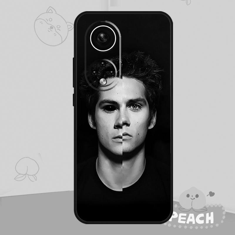 Dylan O'Brien Teen Wolf Case For Honor Magic 8 6 7 Pro Honor 400 200 70 90 Lite X8b X8c X9a X9b X9c X9d Win RT Cover