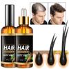 Anti Hair Loss Spray Products Hair Serum Essential Oil Ginger Treatment Dry Frizzy Damaged Hair Nourish