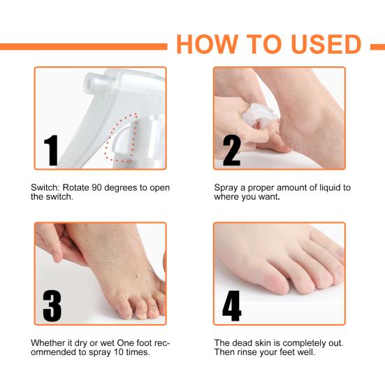 30 мл/100 мл EELHOE спрей для пилинга ног, глубоко питательный, быстро впитывающийся, аксессуар для ног, отшелушивающий спрей для омертвевшей кожи