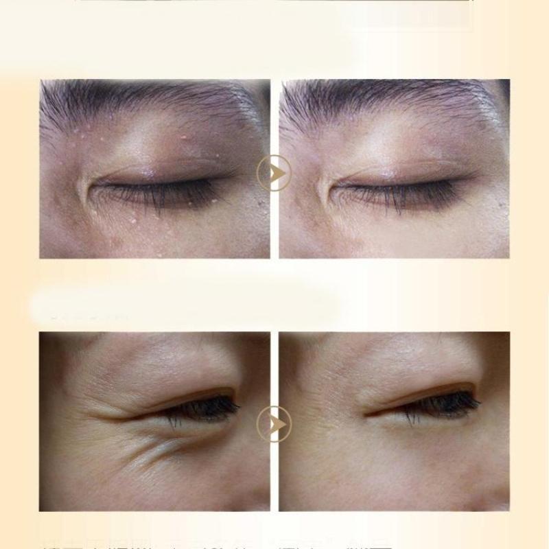 Укрепляющий крем для глаз с лошадиным маслом от темных кругов, морщин, жировых гранул и антивозрастной эссенции для глаз, крем для удаления темных кругов под глазами(5г/15г/30г/50г)