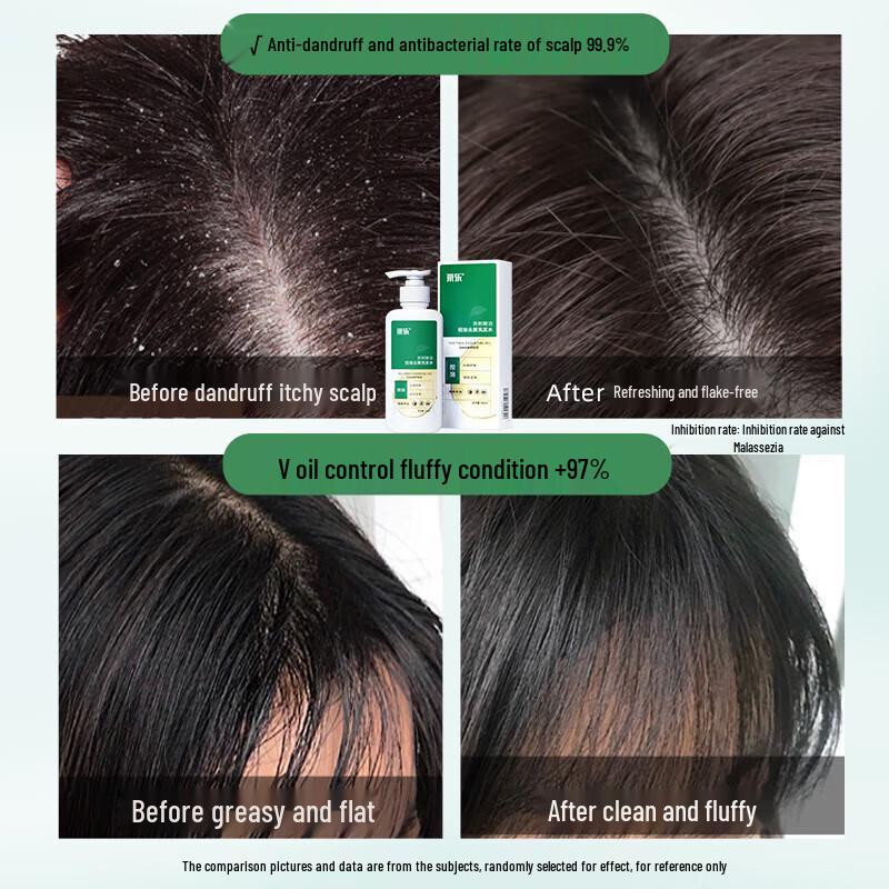 Cai Le Tea Tree Oil Anti-Dandruff & Oil Control Shampoo