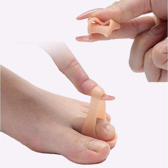 Корректор для разделителя пальцев ног SEBS Toe Pad Straightener Инструмент для ухода за ногами Новый