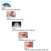 Oral Hygiene Mouth Guard Alignment  Aligner Mouthpiece Trainer Teeth Retainer Orthodontic Braces
