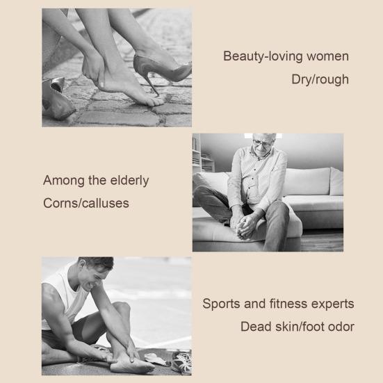 Электрический прибор для удаления мозолей на ногах, 2 скорости, регулируемый, USB-устройство для удаления омертвевшей кожи на ногах
