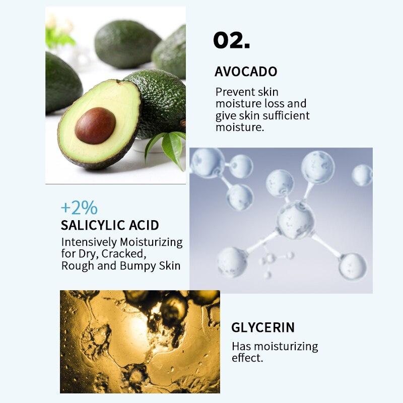 Крем с мочевиной для расщелины ног Крем с мочевиной для потрескавшихся ног сохраняет кожу увлажненной, предотвращает повреждение кожи