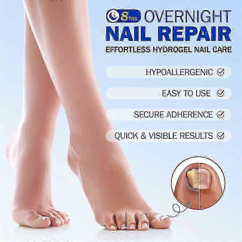 2025 Fungus Patch Waterproof Nail Repair Patches, Ingrown Nail Correction Stickers, 1/2/3/4/5pcs for Discolored or Damaged Nails