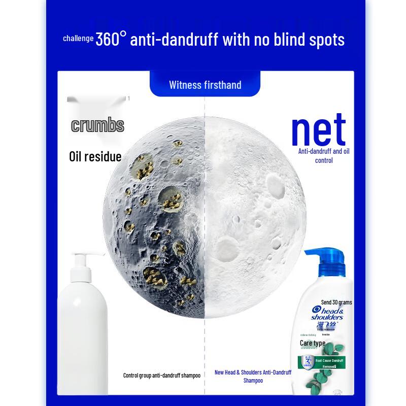 Шампунь Head & Shoulders от зуда и перхоти 430 мл