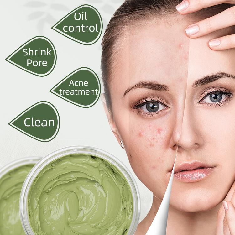 Маска из глины чайного дерева для удаления прыщей на лице, крем-маска для очищения лица, средство для удаления черных точек и черных точек, уход за кожей