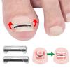 Titanium Alloy Toenail Correction Wire Ingrown Nail Treatment Device Stickers Silicone Tool Foot Care Accessories Daily Use