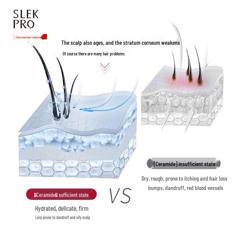 SLEK Scalp Refreshing Oil Control Anti-Dandruff Shampoo