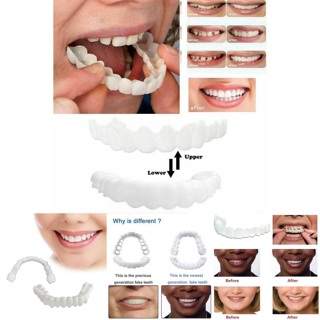 On Fake Snap Teeth Upper Lower Dental Veneers Denture Tooth Cover Simulation Set