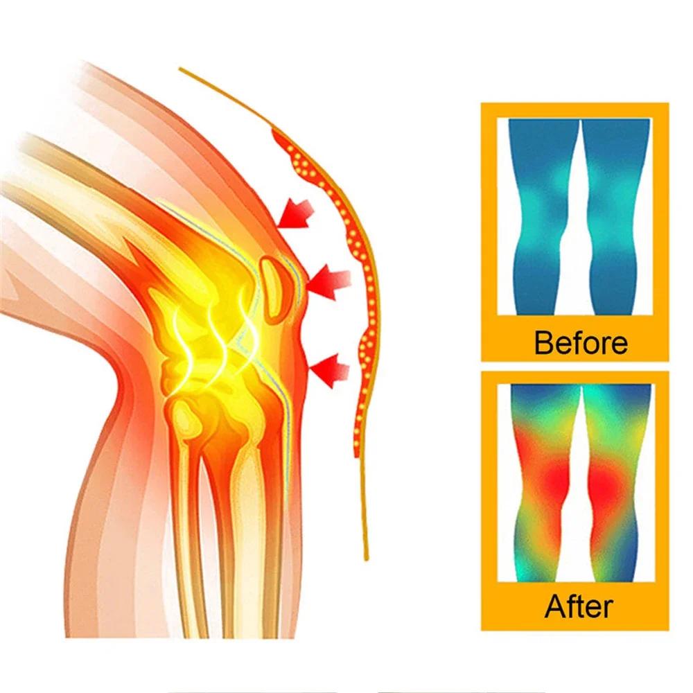 1Pair Self Heating Support KneePad Knee Brace Warm for Arthritis Joint Pain Relief Injury Recovery Belt Knee Massager Leg Warmer