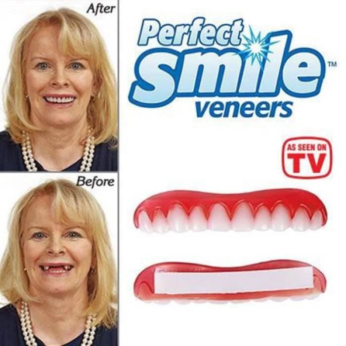 Veneers Perfect Smile Dub YWEI - Correction des Dents - Adulte