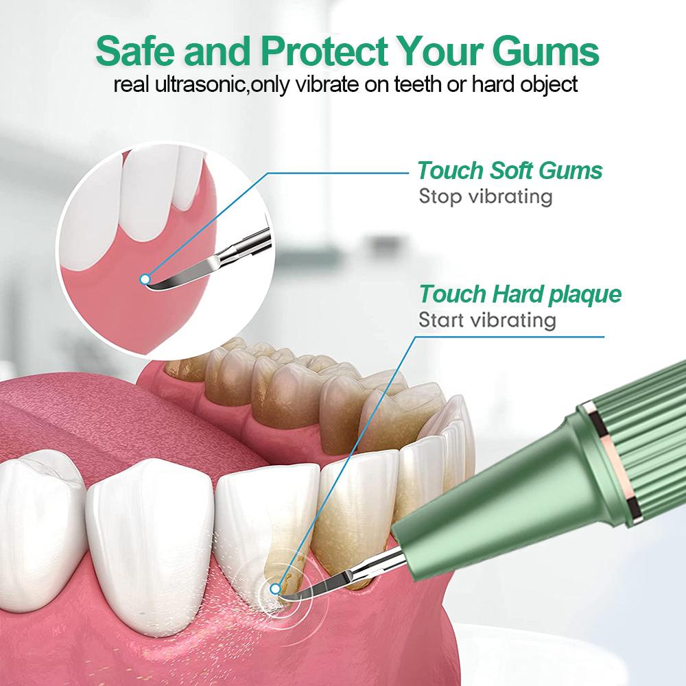Стоматологический скалер для удаления зубного камня, Электрический очиститель зубов, средство для удаления зубного камня, ультразвуковое удаление зубного камня