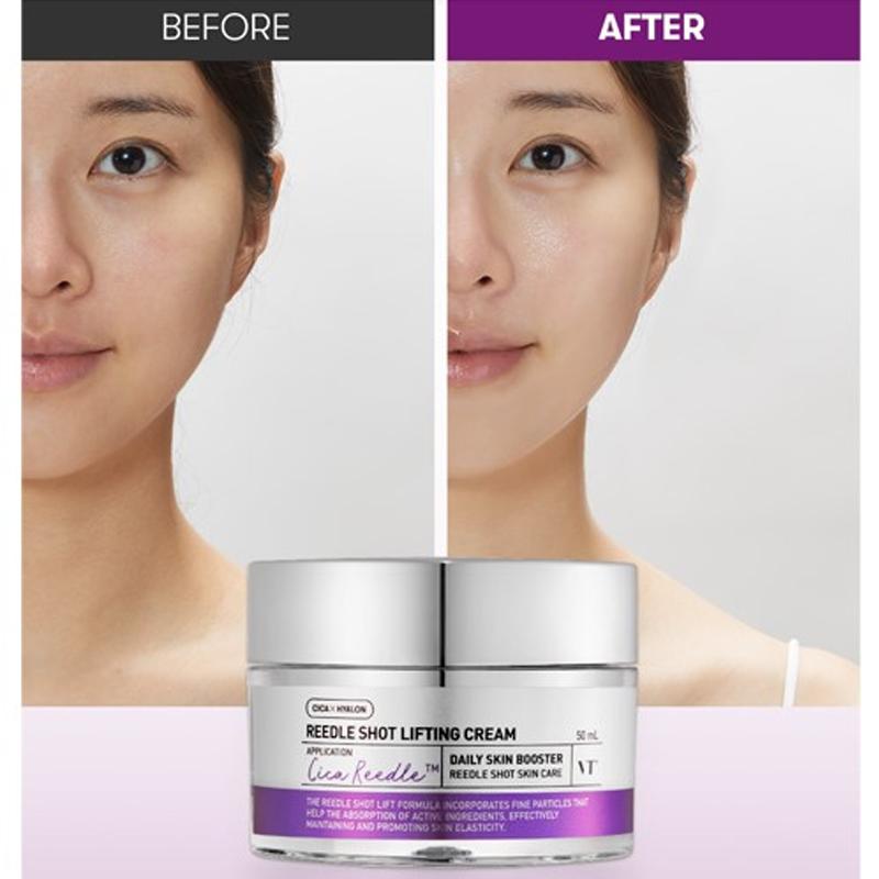 VT COSMETICS Reedle Shot Lifting Cream 50ml