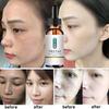 Whitening Freckle Cream Effective Remove Melasma Dark Spots Cream Fade  Moisturize Brighten Smooth Beauty Face Skin Care