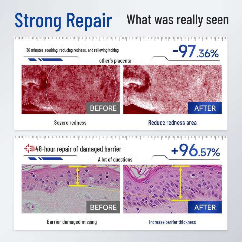 Naxi Multi-Peptide Skin Repair & Soothing Freeze-Dried Powder Set