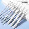 Набор инструментов для удаления черных точек Набор игл для удаления прыщей из нержавеющей стали