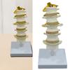 Five Segment Lumbar Spine Model Human Anatomical Lumbar Spine Model Pathological Lumbar Spine Anatomy Model for Research