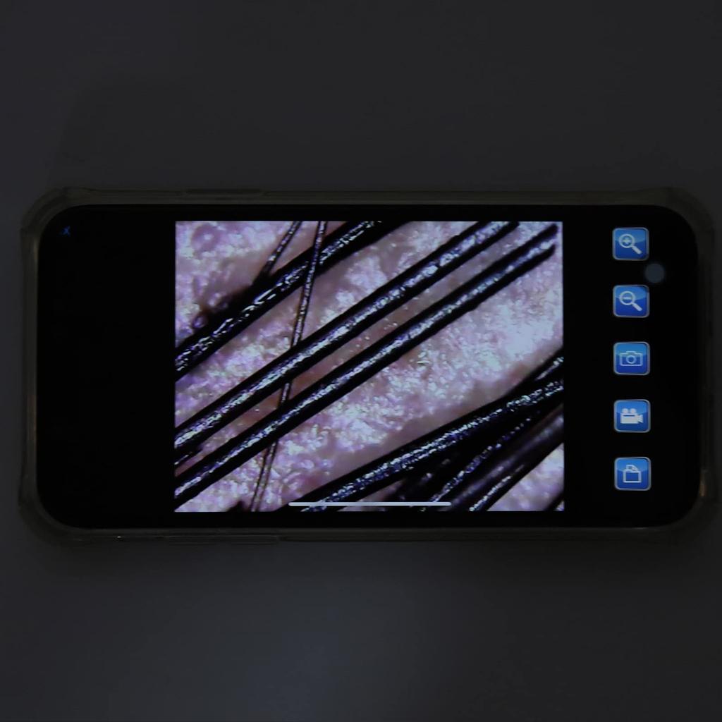 Wireless Digital Microscope, 800X Magnification USB Skin Diagnostic Hair Follicle Analyzer, WiFi Portable Handheld Microscope, Skin, Hair, and Scalp