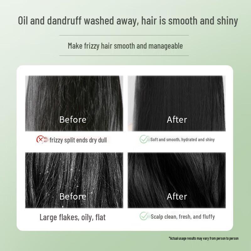 Rainclean Forest Wood Scent Anti-Dandruff Shampoo