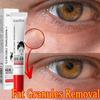 Fat Granules Remover Eye Cream Anti-Puffiness Anti Inflammatory Reduce Dark Circles Fade Fine Lines Repair Barrier Firm Cream
