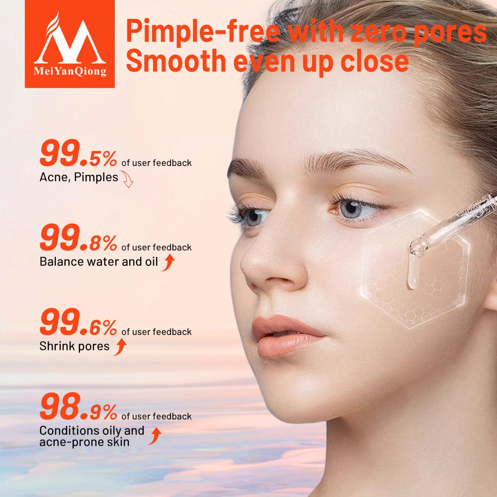 Отбеливающая эссенция для сужения пор с экстрактом гамемелиса 10мл