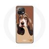 Чехол для Xiaomi Mi 11 Lite с мордой собаки Basset Hound
