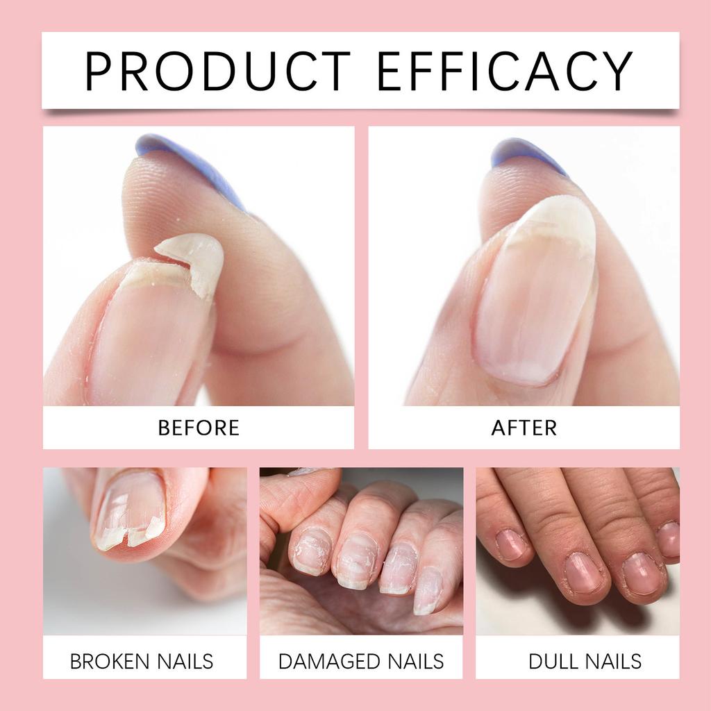 Nail Care Liquid With Herbal Ingredients Gently Nourishes Soft, Thick And Smooth Nail Surfaces,30ML