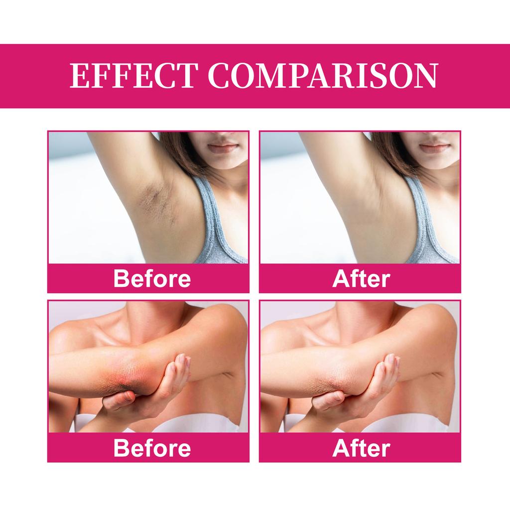 Whitening and Beautifying Cream for Armpits, Moisturizing, Darkening, Brightening and Whitening Cream for Private Parts of Elbow and Knee Joints.