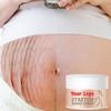 Best Selling Natural Organic Anti Pregnant Scar Skin Care Repair Treatment  Cream