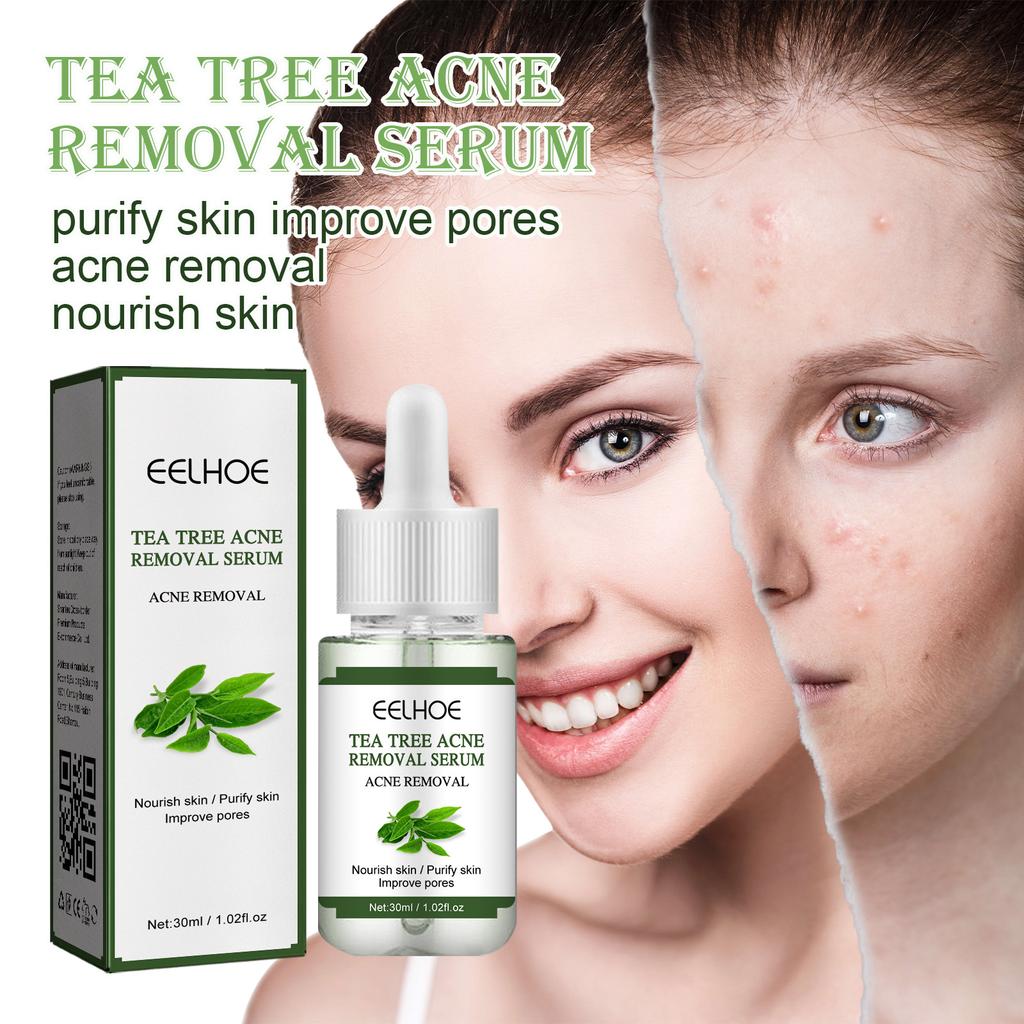 EELHOE Tea Tree Acne Repair Essence Осветляет следы от прыщей Очищает прыщи Устраняет прыщи Восстанавливает кожу Увлажняющая эссенция
