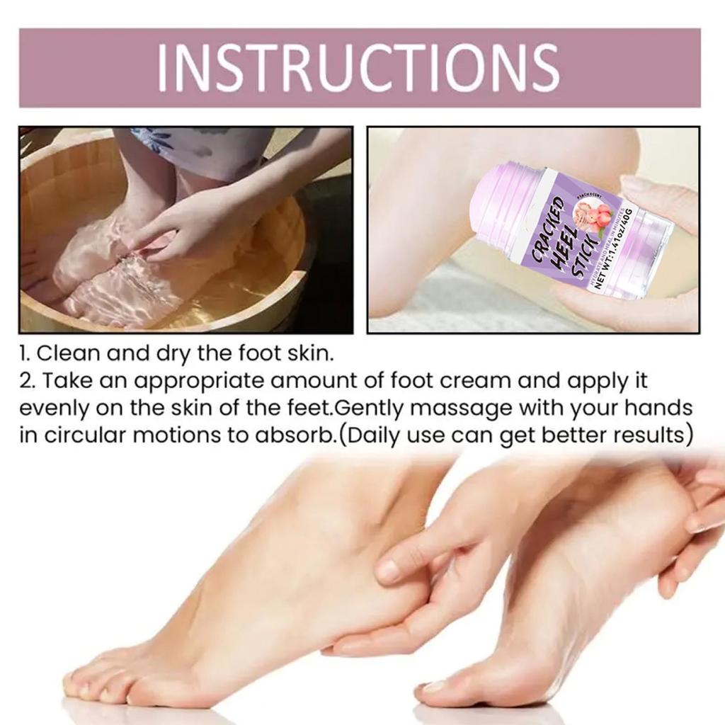 Urea Foot For Dry Cracked Heels Urea Foot Moisturizing Stick For Dry Cracked Heels Moisturizer For Feet & Hands