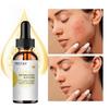 Retinol Serum Anti Wrinkle Fade Dark Spots Vitamin C Facial Serum Whiten Face Skincare Essence Skin Care Products