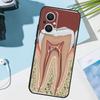 Чехол-обложка с анатомией человеческого зуба для OPPO Reno 14F 13F 12F 11F 8T 7 8 Lite 10 11 12 13 14 OPPO Find X9 X8 X5 X6 Pro