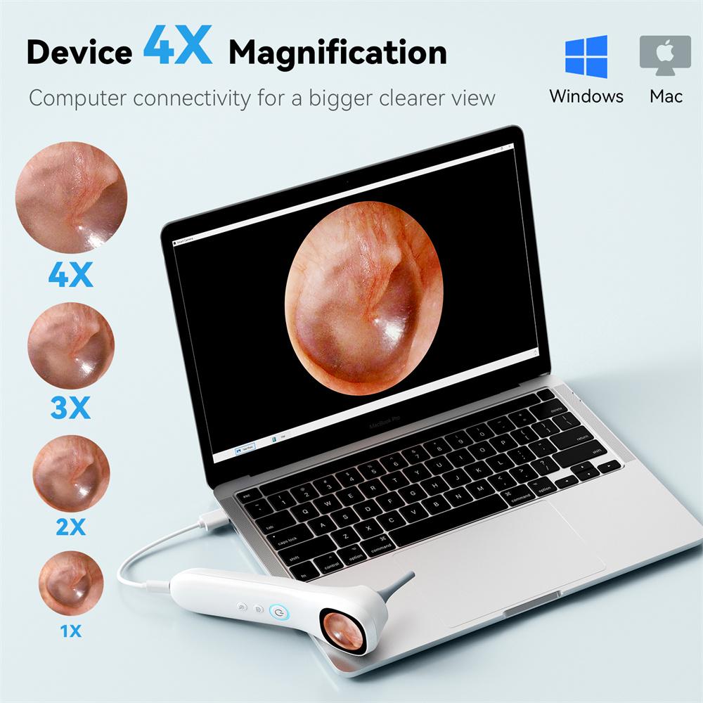 1080P HD Ear Camera 5-in-1 Smart Detector with Screen Ear Scoop Set 6 Replacement Ear Scoops 12 Replacement Check Heads Ear Tool
