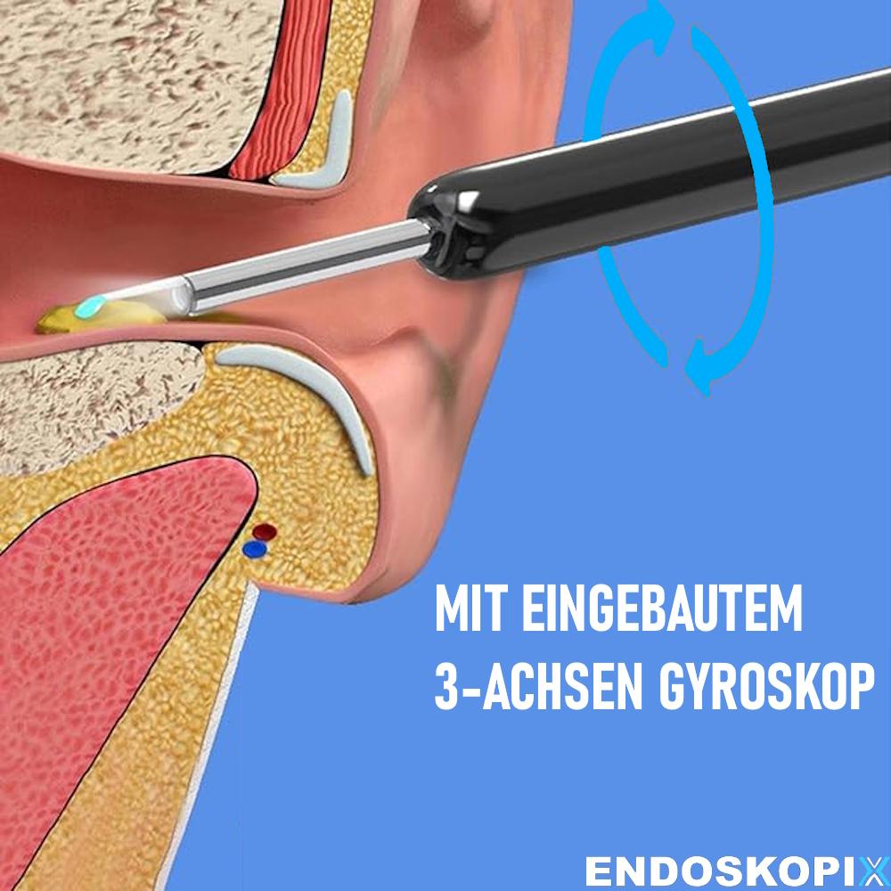 ENDOSKOPIX Electric Ear Cleaner Camera Ear Cleaning Earwax