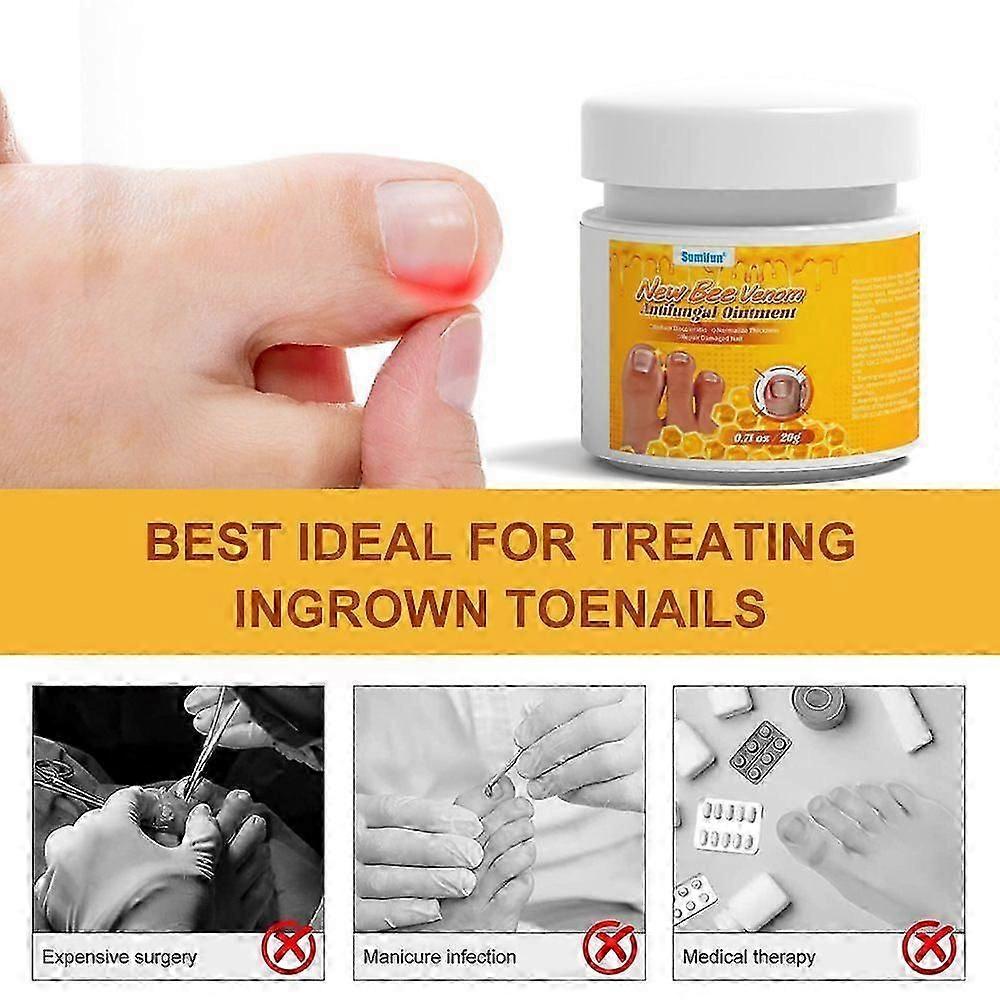 Bee Venom Antifungal OintmentBee Venom Nail Repair ointment, Bee Venom Nail Repair cream,Repair Damaged Nails
