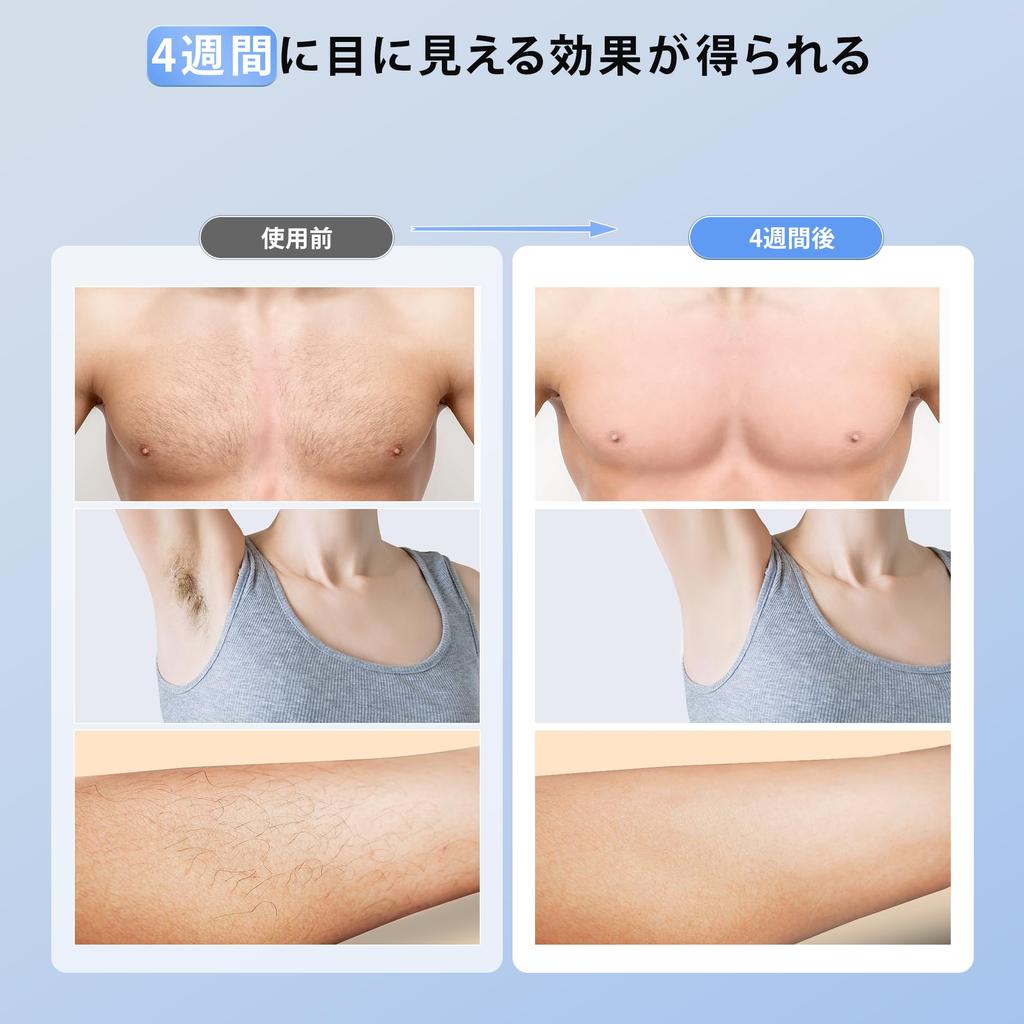 Устройство для удаления волос YUNDOO, класс охлаждения, удаление волос IPL, устройство для удаления волос, совместимое с 9 уровнями высокого времени облучения, удаление волос