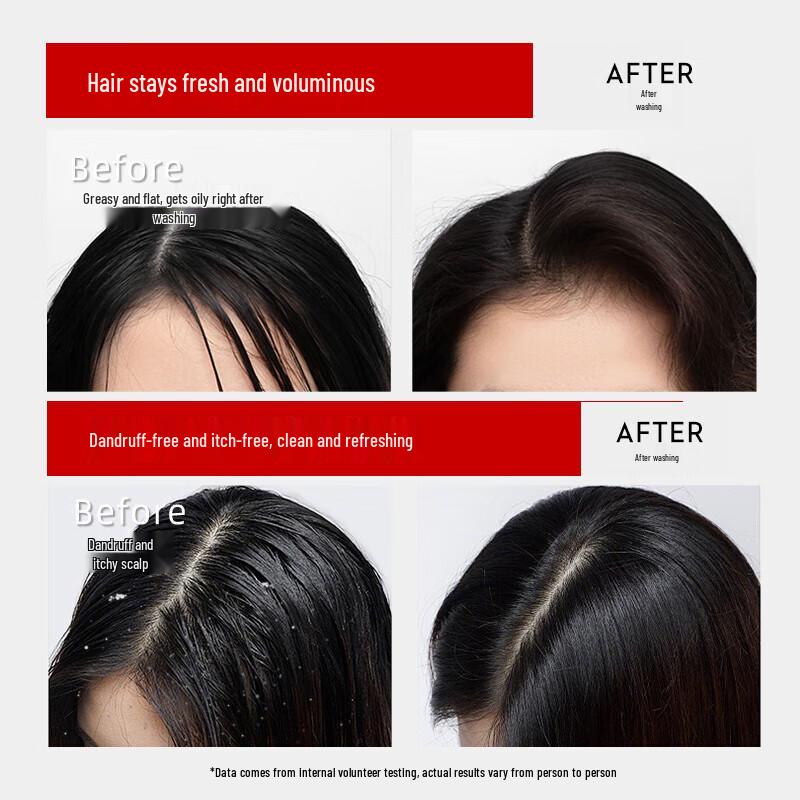 Cai Le Bifida Ferment Essence Shampoo