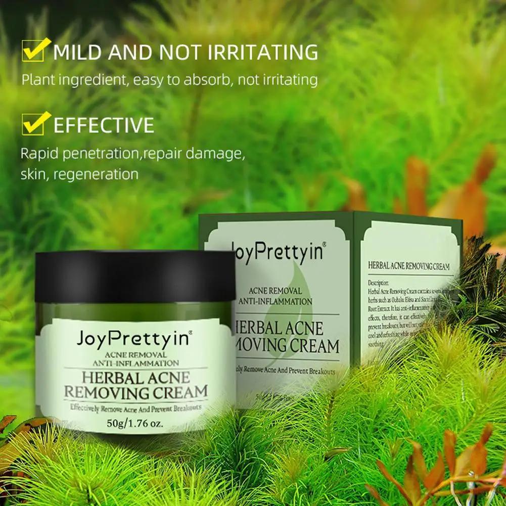 Крем для лица от прыщей, устранение больших пор, лечение прыщей, контроль жирности, сужение пор, крем для лица, уход за кожей, красота, здоровье