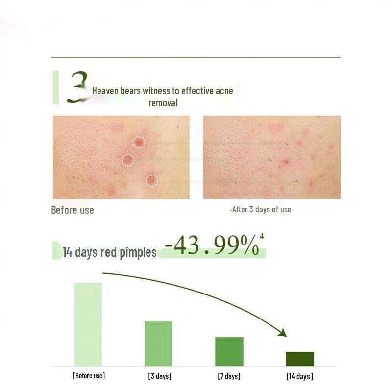 Гель-пенка для умывания Pond's Acne Clear с мятой